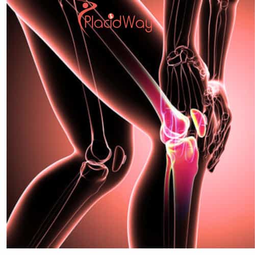 Stem Cell Treatment for Knee Pain in Japan for American Patients